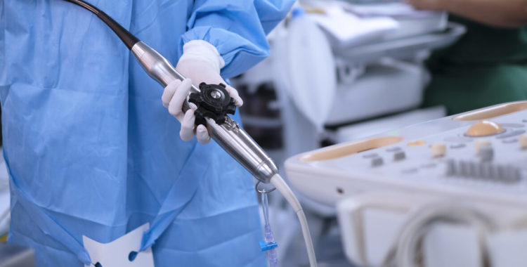 Transesophageal Echocardiogram