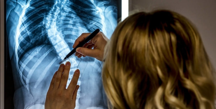 Scoliosis specialist Doctor with patients X-Ray