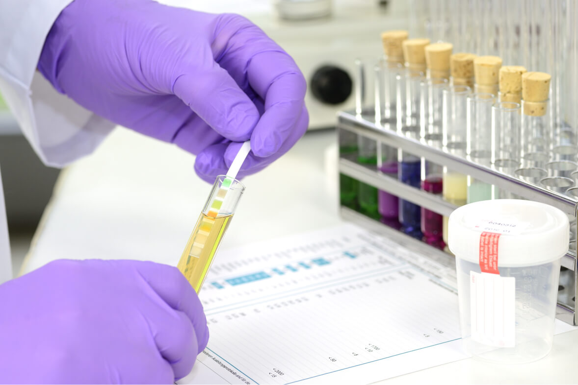 Make Drug Testing Required in Your Working environment