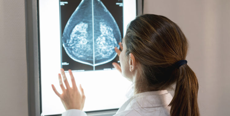 Unrecognizable female gynocologist looking at a mammogram at the hospital