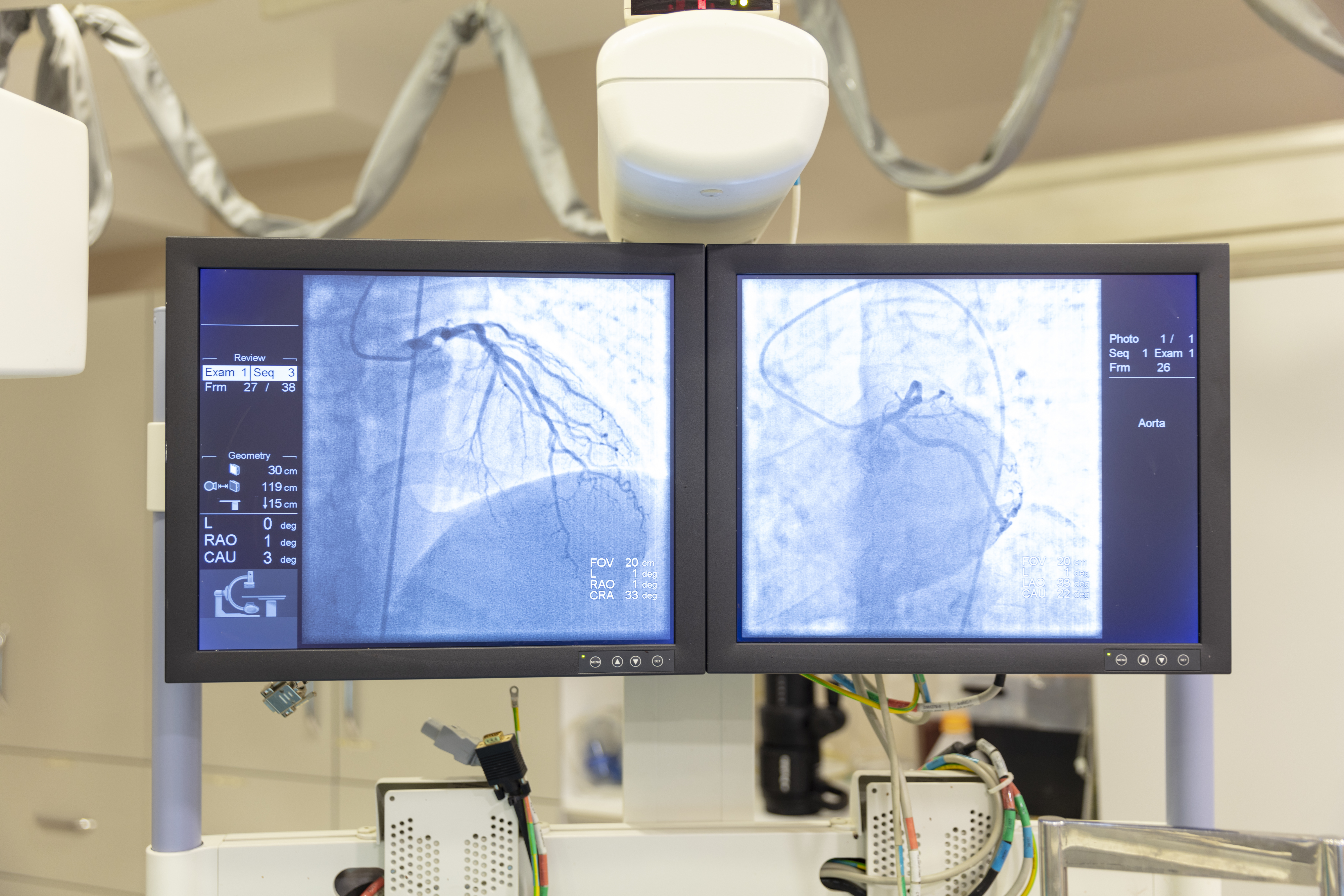 View of modern medical X-ray operating room (cath lab)