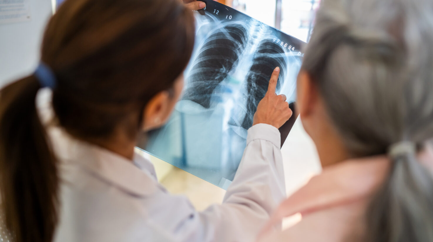 Doctors Analyzing a Chest X-Ray in Hospital